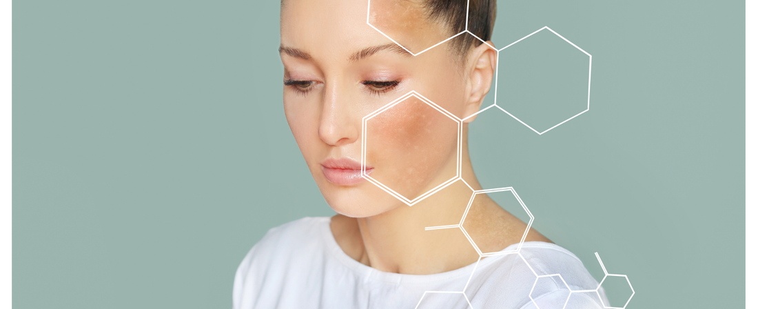 Peau sèche ou désydratée... Comment faire la différence ?