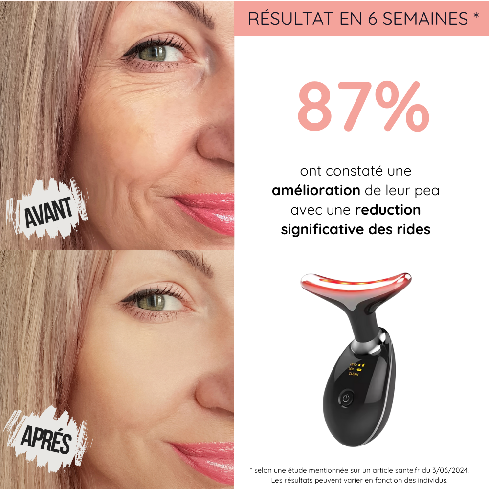 SkinAura